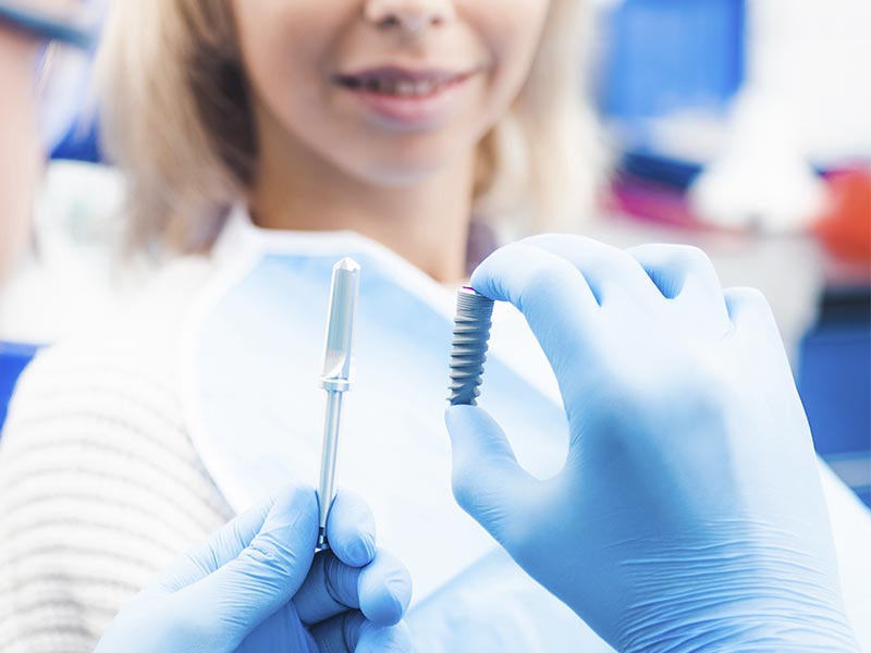 Implantes dentales en Díez Marieges