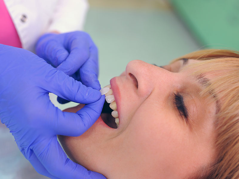 Tratamientos-carillas-dentales-que-solucionan