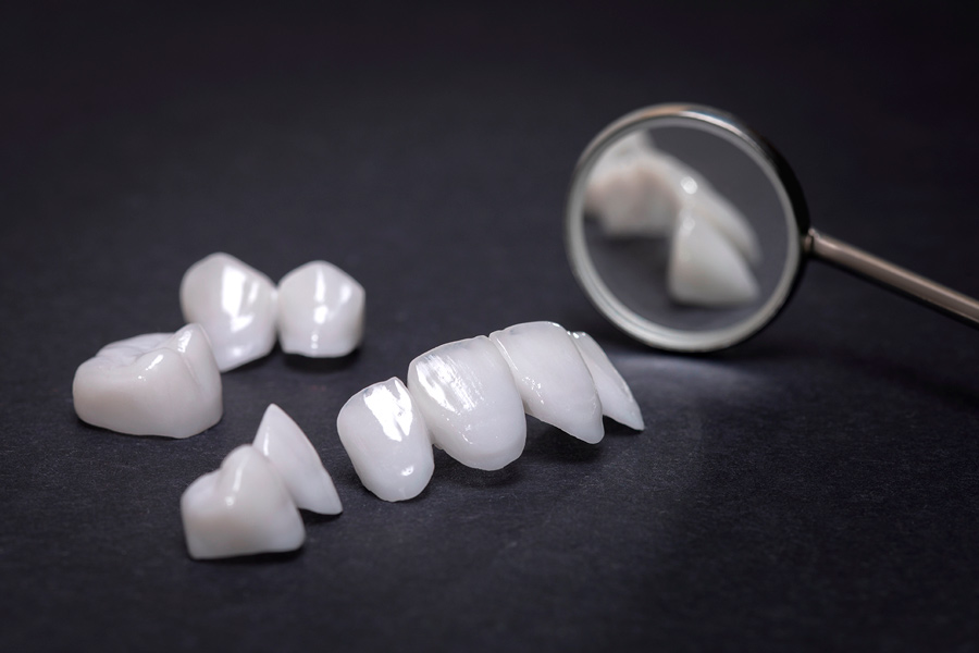 carillas-dentales-clinica-barcelona