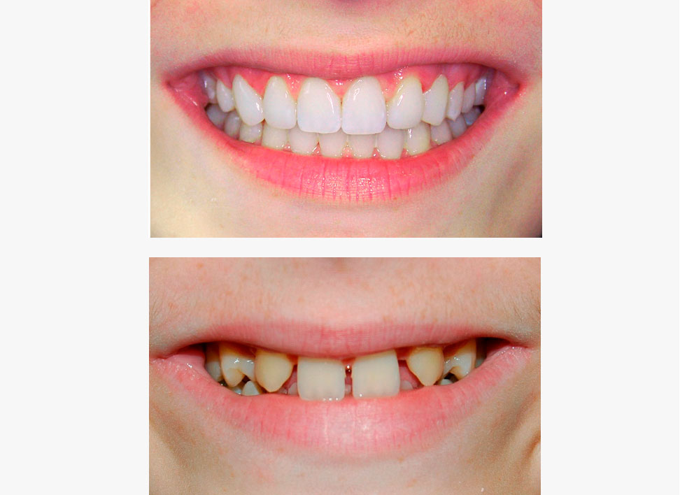 Caso complejo dental