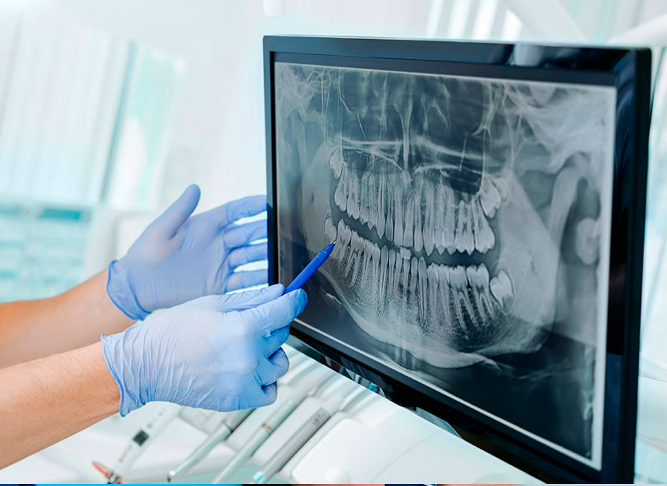 diagnostico-endodoncia