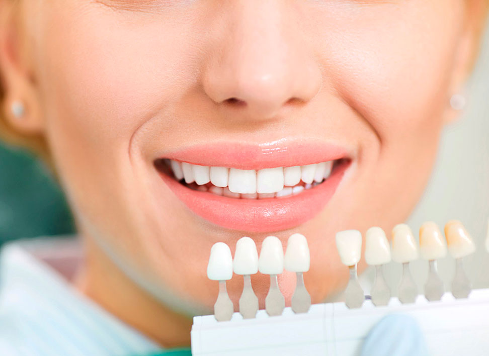 estética_dental_clinica_dental_barcelona