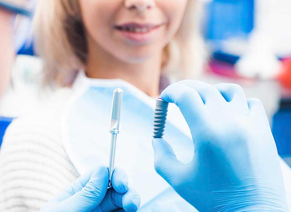 implantes_dentales