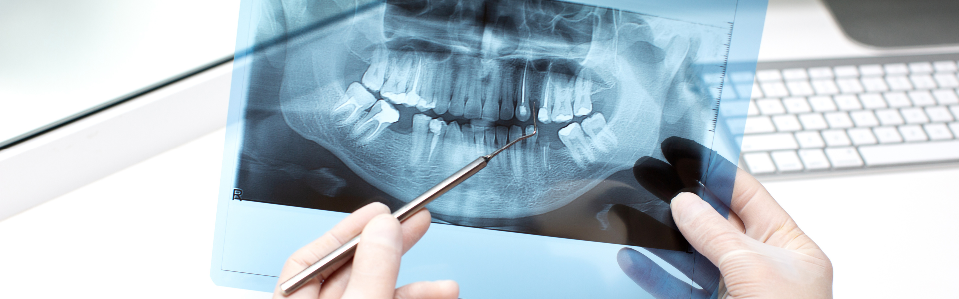 casos complejos odontologia